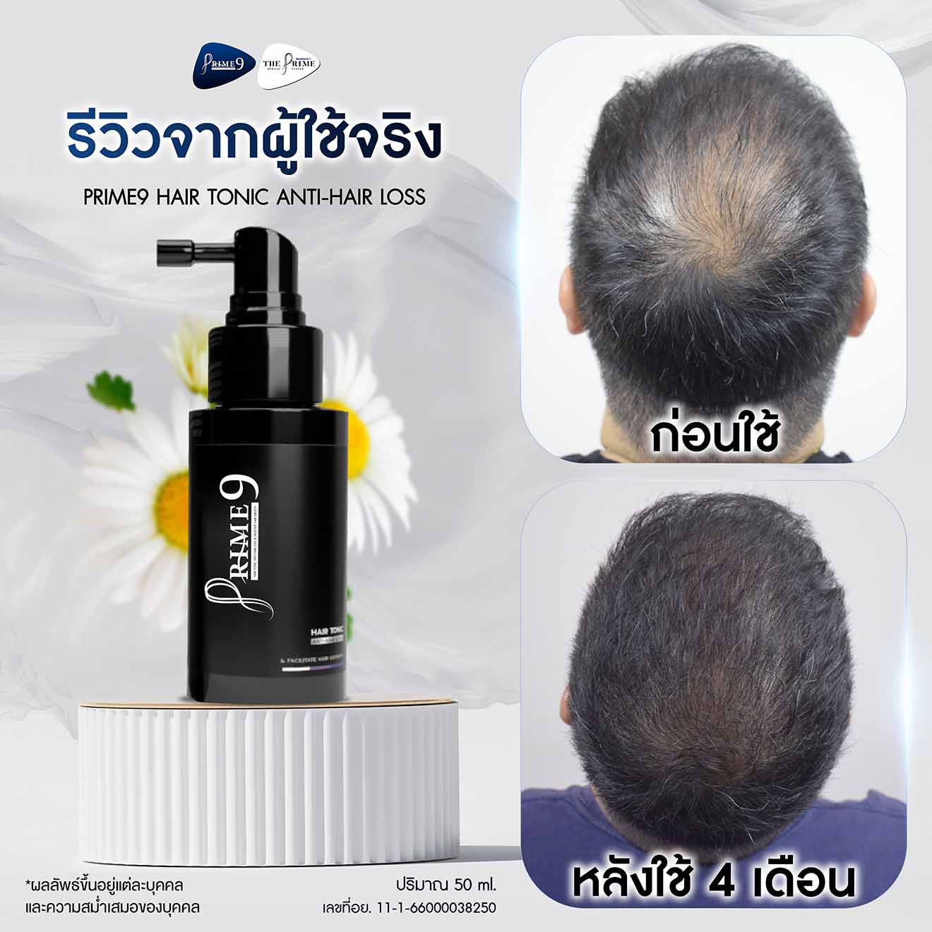 ภาพรีวิว (1-5) - Prime9 Hair-01