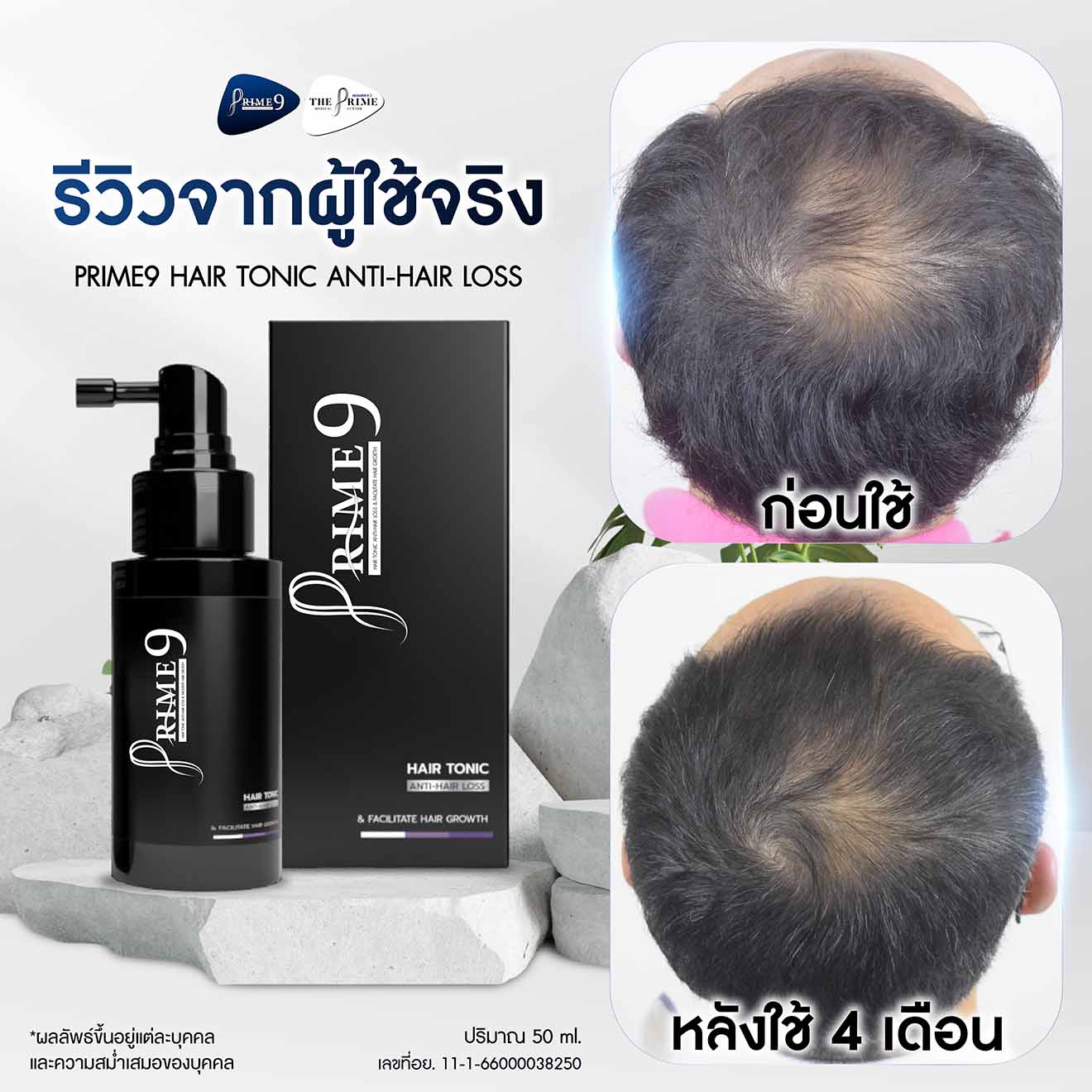 ภาพรีวิว (4-5) - Prime9 Hair-01